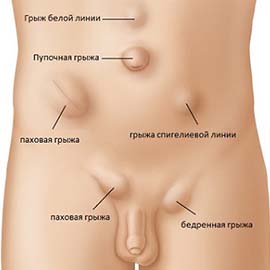 Хриза
